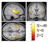 Spray Foam Insulation Nc Images
